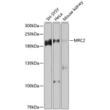 Western Blot - Anti-MRC2/ENDO180 Antibody (A12405) - Antibodies.com