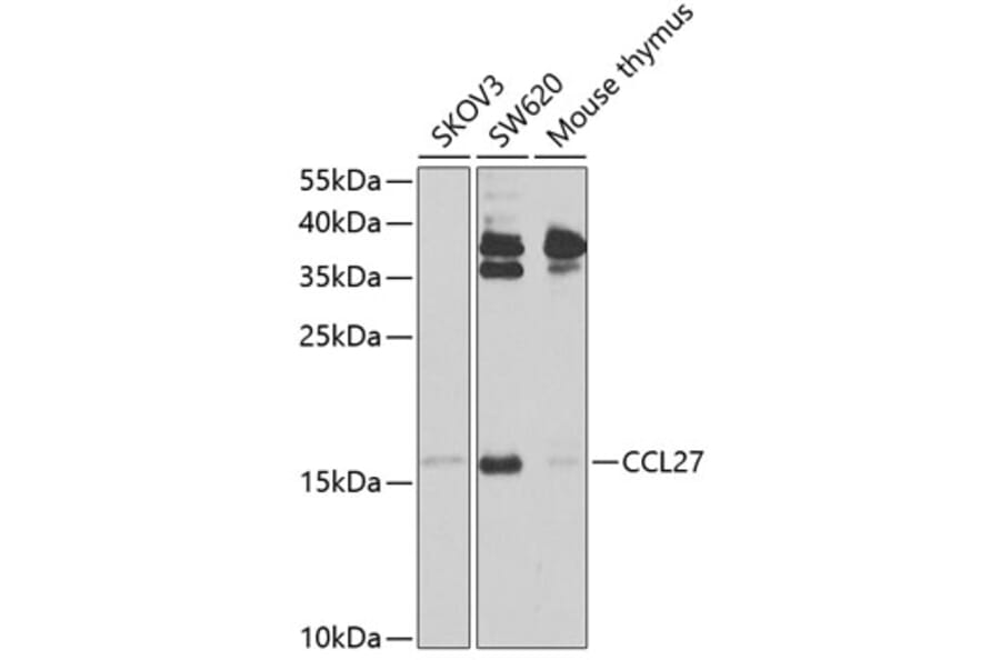 Western Blot - Anti-CCL27 Antibody (A12406) - Antibodies.com