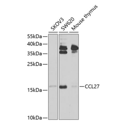 Western Blot - Anti-CCL27 Antibody (A12406) - Antibodies.com