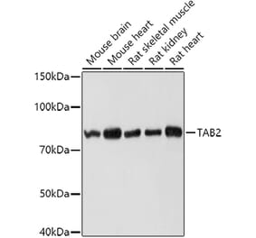 Western Blot - Anti-TAB2 Antibody (A12407) - Antibodies.com