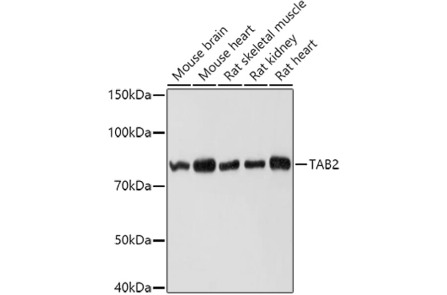 Western Blot - Anti-TAB2 Antibody (A12407) - Antibodies.com