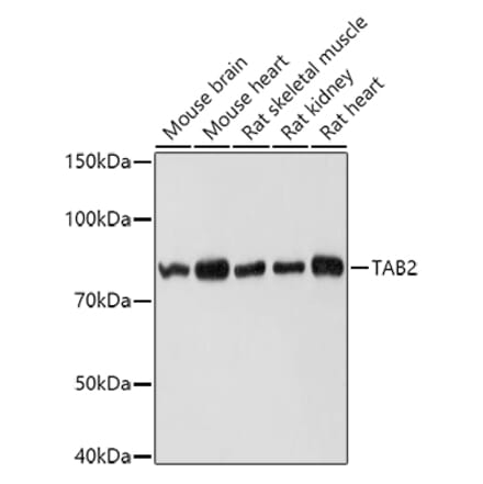 Western Blot - Anti-TAB2 Antibody (A12407) - Antibodies.com