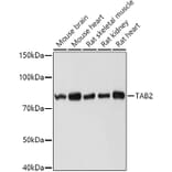 Western Blot - Anti-TAB2 Antibody (A12407) - Antibodies.com