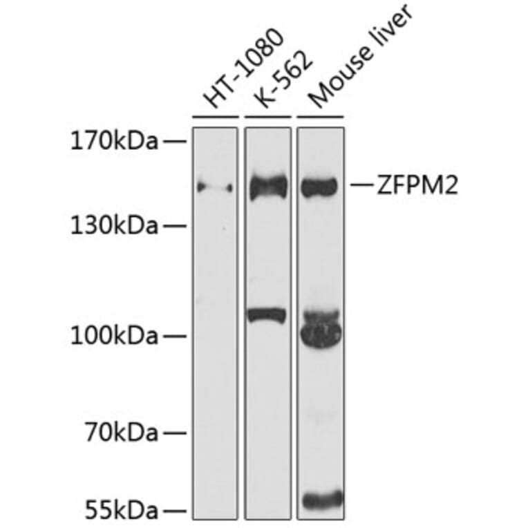 Western Blot - Anti-FOG2 Antibody (A12408) - Antibodies.com
