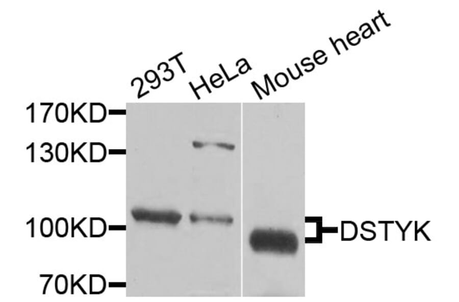 Western Blot - Anti-DSTYK Antibody (A9870) - Antibodies.com