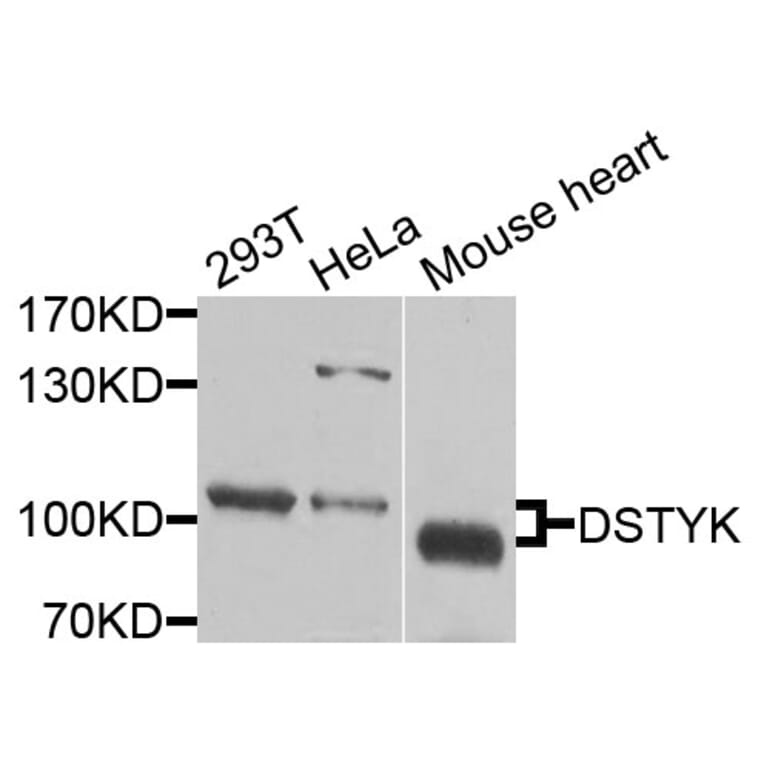 Western Blot - Anti-DSTYK Antibody (A9870) - Antibodies.com