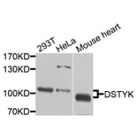 Western Blot - Anti-DSTYK Antibody (A9870) - Antibodies.com