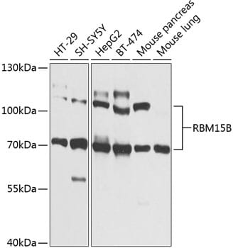 Western blot analysis of extracts of various cell lines, using Anti-RBM15B Antibody (A9873) at 1:1,000 dilution.
Secondary antibody: Goat Anti-Rabbit IgG (H+L) (HRP) (AS014) at 1:10,000 dilution.
Lysates / proteins: 25µg per lane.
Blocking buffer: 3% non-fat dry milk in TBST.
Detection: ECL Basic Kit (RM00020).
Exposure time: 1s.