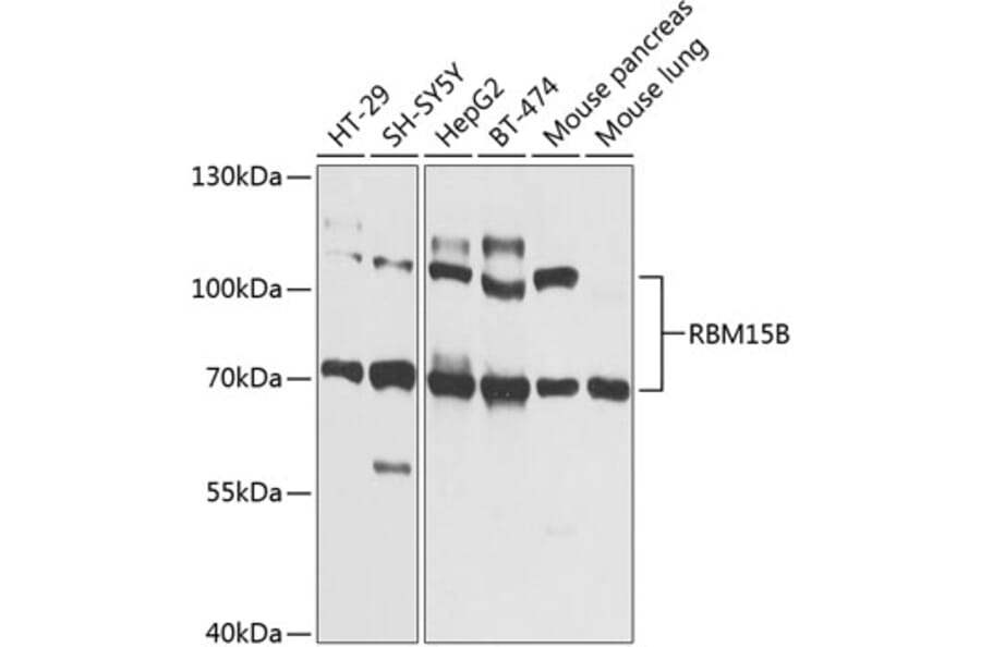 Western Blot - Anti-RBM15B Antibody (A12410) - Antibodies.com