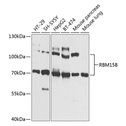 Western Blot - Anti-RBM15B Antibody (A12410) - Antibodies.com