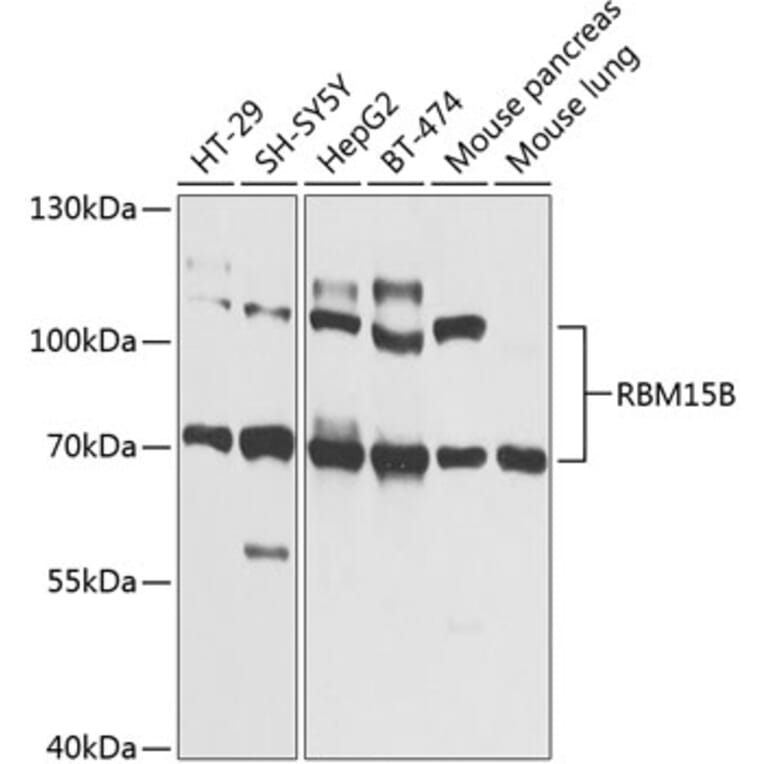 Western Blot - Anti-RBM15B Antibody (A12410) - Antibodies.com