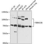 Western Blot - Anti-RBM15B Antibody (A12410) - Antibodies.com