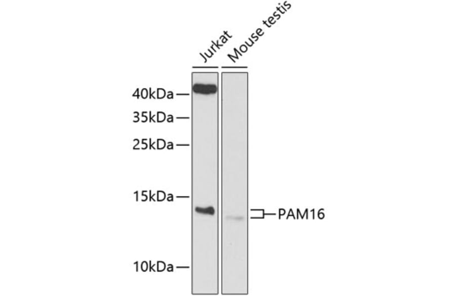 Western Blot - Anti-MAGMAS Antibody (A12411) - Antibodies.com