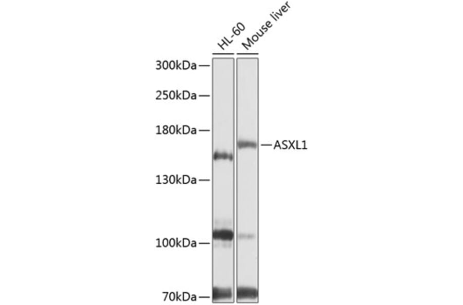 Western Blot - Anti-ASXL1 Antibody (A9890) - Antibodies.com