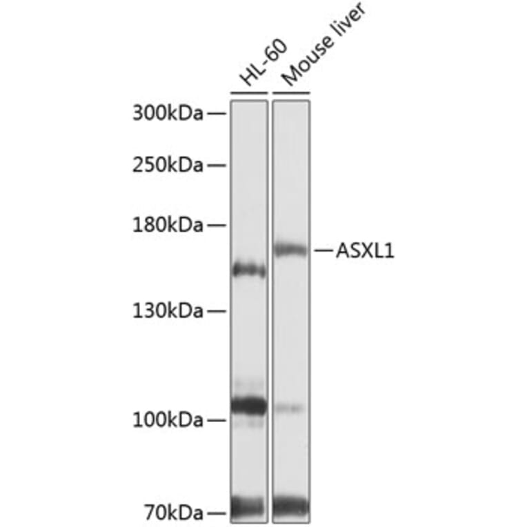 Western Blot - Anti-ASXL1 Antibody (A9890) - Antibodies.com