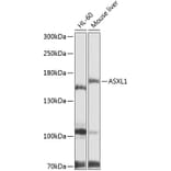Western Blot - Anti-ASXL1 Antibody (A9890) - Antibodies.com