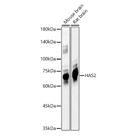 Western Blot - Anti-Hyaluronan synthase 2 Antibody (A12414) - Antibodies.com