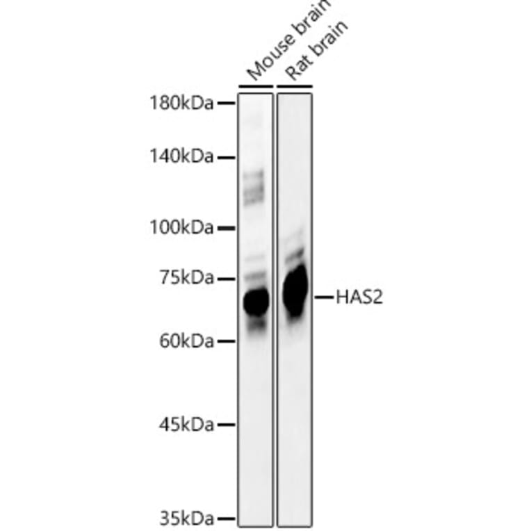 Western Blot - Anti-Hyaluronan synthase 2 Antibody (A12414) - Antibodies.com