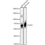 Western Blot - Anti-Hyaluronan synthase 2 Antibody (A12414) - Antibodies.com