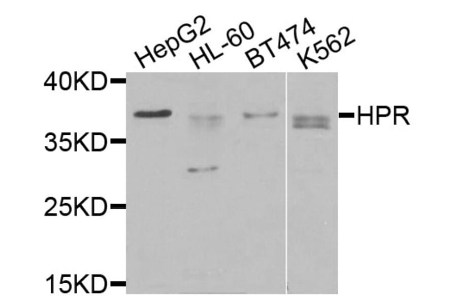 Western Blot - Anti-HPR Antibody (A9898) - Antibodies.com