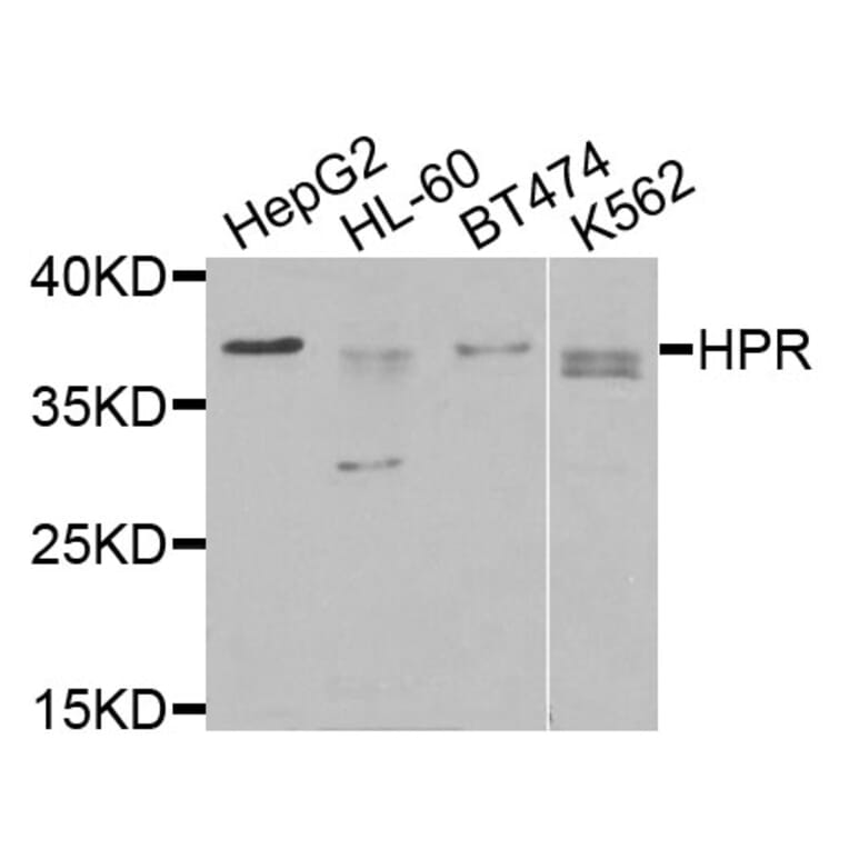Western Blot - Anti-HPR Antibody (A9898) - Antibodies.com