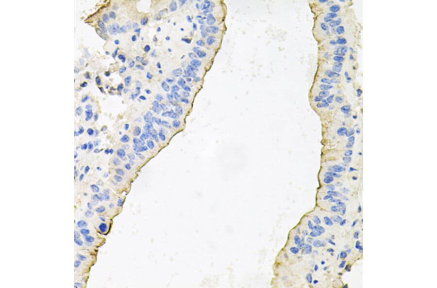 Immunohistochemistry - Anti-HPR Antibody (A9898) - Antibodies.com