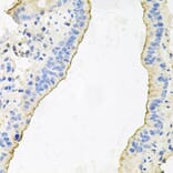 Immunohistochemistry - Anti-HPR Antibody (A9898) - Antibodies.com