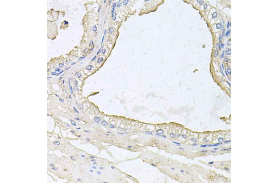 Immunohistochemistry - Anti-HPR Antibody (A9898) - Antibodies.com