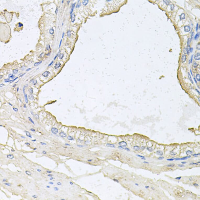 Immunohistochemistry - Anti-HPR Antibody (A9898) - Antibodies.com