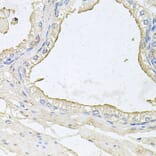 Immunohistochemistry - Anti-HPR Antibody (A9898) - Antibodies.com