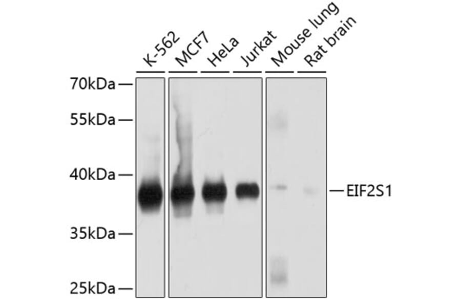 Western Blot - Anti-EIF2S1 Antibody (A9905) - Antibodies.com
