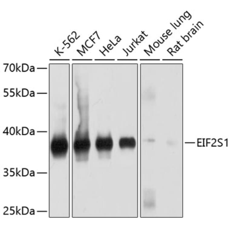 Western Blot - Anti-EIF2S1 Antibody (A9905) - Antibodies.com