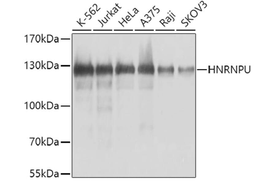 Western Blot - Anti-HNRNPU Antibody (A9907) - Antibodies.com