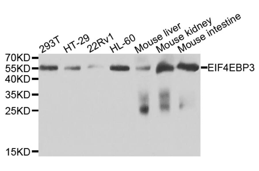 Western Blot - Anti-EIF4EBP3 Antibody (A9913) - Antibodies.com