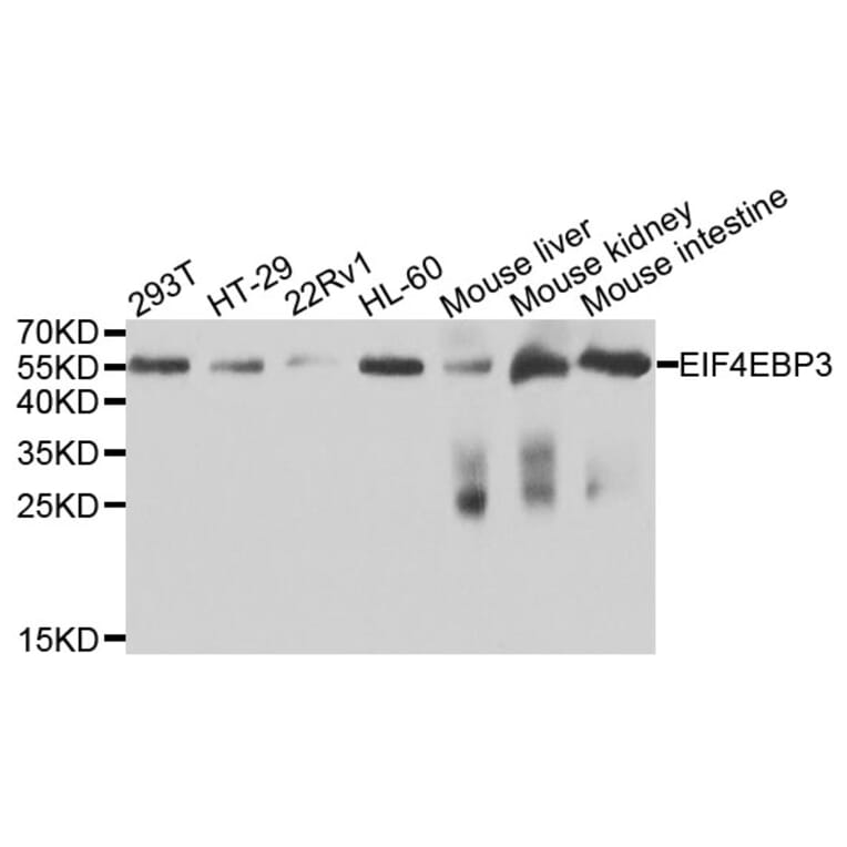 Western Blot - Anti-EIF4EBP3 Antibody (A9913) - Antibodies.com