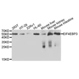 Western Blot - Anti-EIF4EBP3 Antibody (A9913) - Antibodies.com