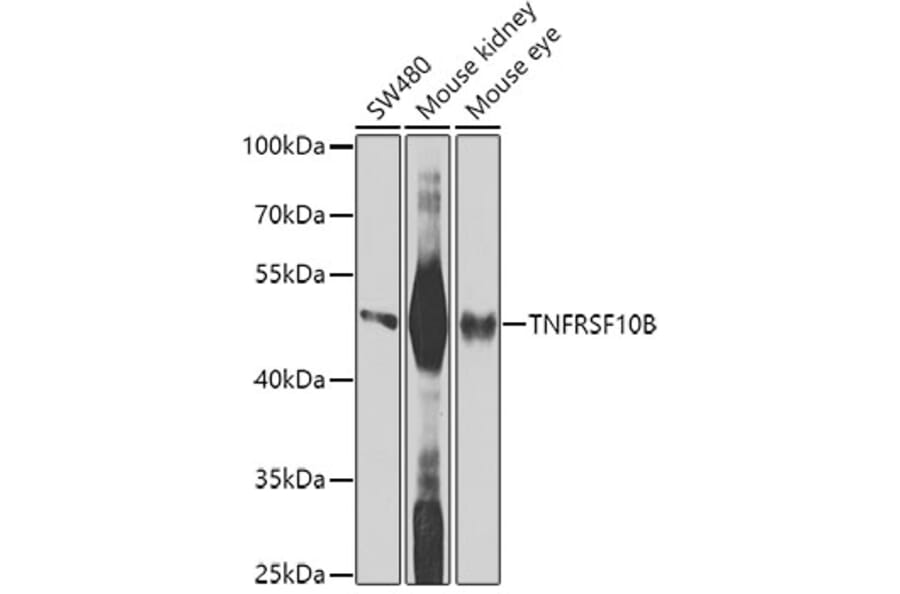 Western Blot - Anti-TNFRSF10B Antibody (A9914) - Antibodies.com