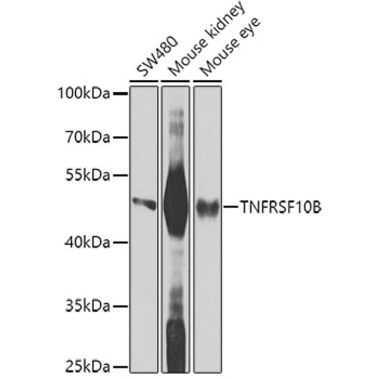 Western Blot - Anti-TNFRSF10B Antibody (A9914) - Antibodies.com