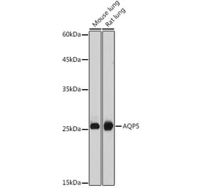 Western Blot - Anti-Aquaporin 5 Antibody (A12421) - Antibodies.com