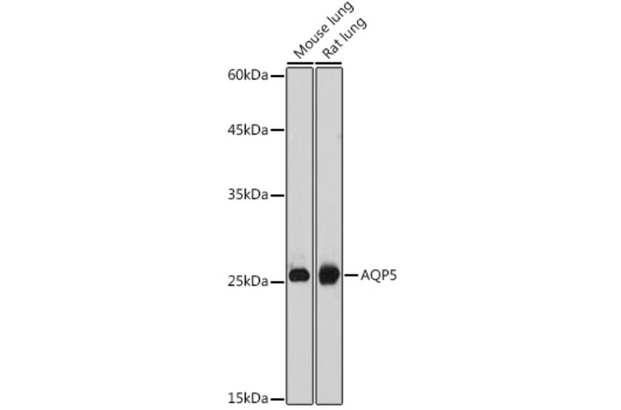 Western Blot - Anti-Aquaporin 5 Antibody (A12421) - Antibodies.com