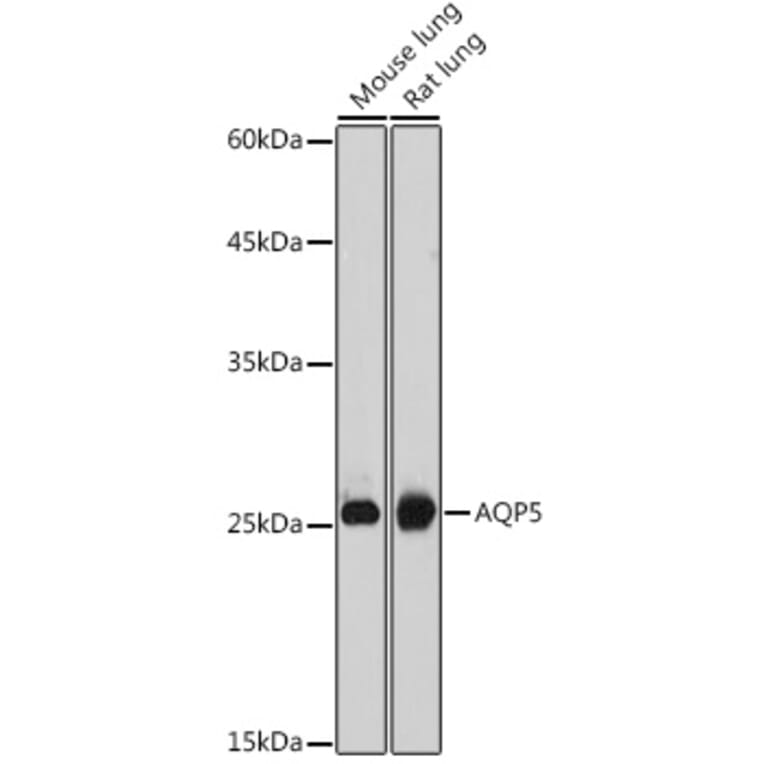 Western Blot - Anti-Aquaporin 5 Antibody (A12421) - Antibodies.com