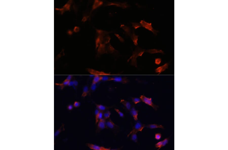 Immunofluorescence - Anti-Aquaporin 5 Antibody (A12421) - Antibodies.com