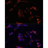 Immunofluorescence - Anti-Aquaporin 5 Antibody (A12421) - Antibodies.com