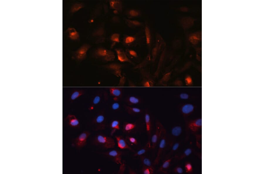 Immunofluorescence - Anti-Aquaporin 5 Antibody (A12421) - Antibodies.com