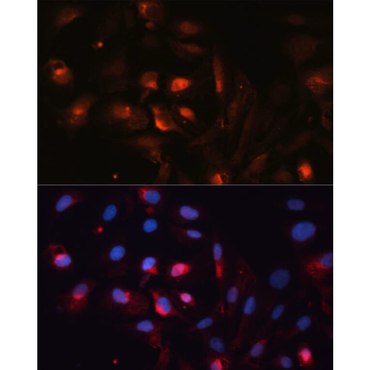 Immunofluorescence - Anti-Aquaporin 5 Antibody (A12421) - Antibodies.com