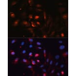 Immunofluorescence - Anti-Aquaporin 5 Antibody (A12421) - Antibodies.com