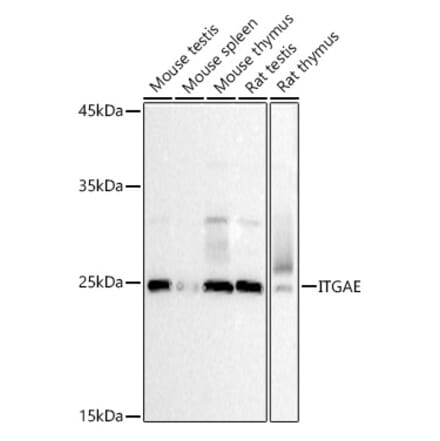 Western Blot - Anti-CD103 Antibody (A12422) - Antibodies.com
