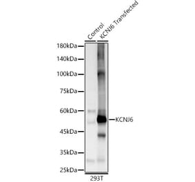 Western Blot - Anti-GIRK2 Antibody (A12423) - Antibodies.com