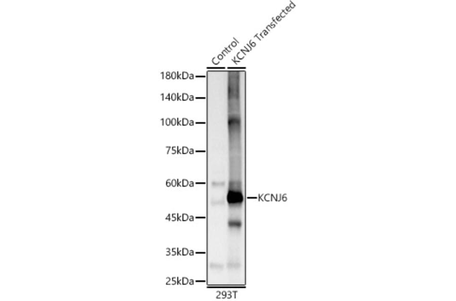 Western Blot - Anti-GIRK2 Antibody (A12423) - Antibodies.com