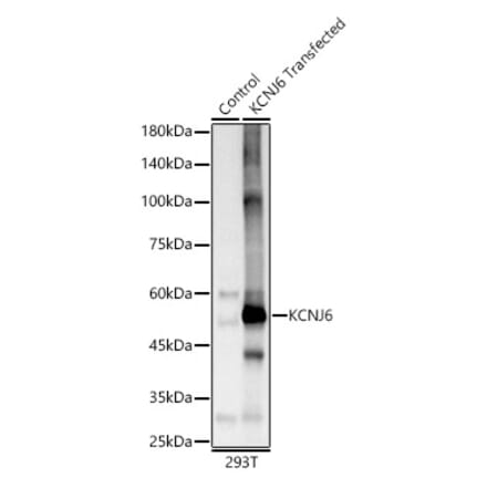 Western Blot - Anti-GIRK2 Antibody (A12423) - Antibodies.com